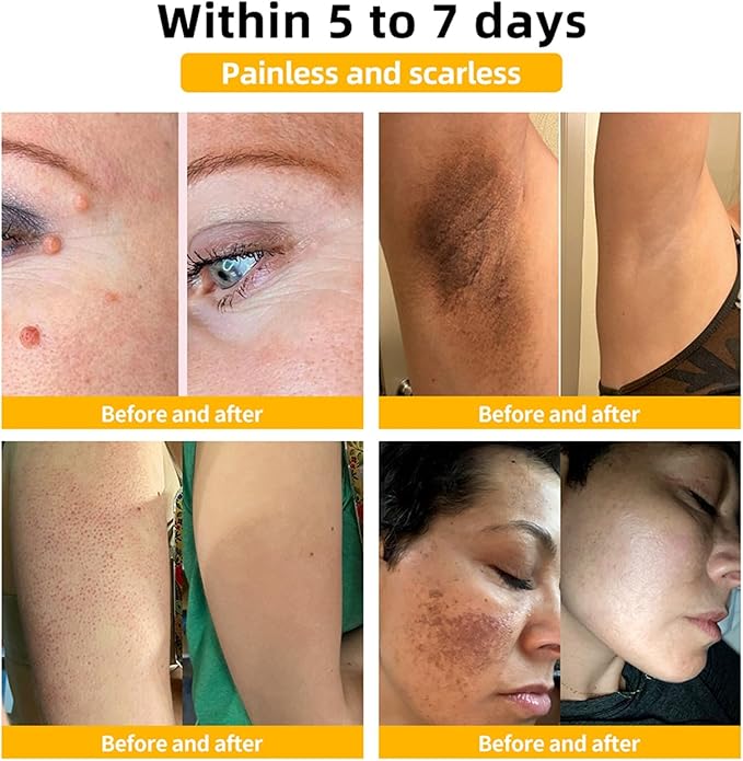 Bee Venom Skin Treatment Cream